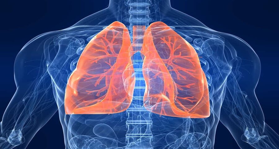 Nguyên nhân bệnh lao màng phổi